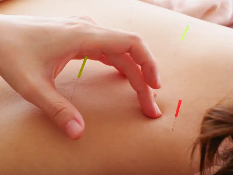 celulitis tratamiento