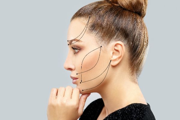 tratamientos médico estéticos para arco mandibular en Leganés