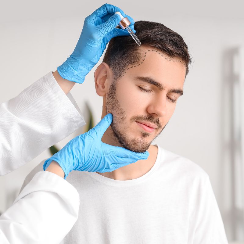 tratamientos para la pérdida de pelo en Leganés
