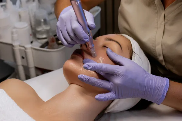 suavizar surco nasogeniano